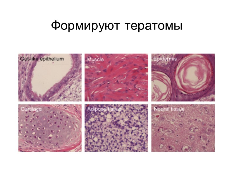 Формируют тератомы
